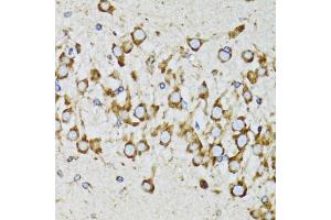 Immunohistochemistry of paraffin-embedded mouse brain using RPN1 antibody. (RPN1 anticorps)