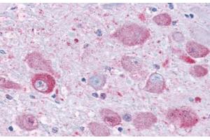 Anti-NPY1R antibody  ABIN1049122 IHC staining of human brain. (NPY1R anticorps  (Cytoplasmic Domain))