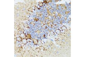 Immunohistochemistry of paraffin-embedded rat cerebellum using NEFH antibody (ABIN5974903) at dilution of 1/100 (40x lens). (NEFH anticorps)
