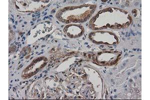 Image no. 11 for anti-Destrin (Actin Depolymerizing Factor) (DSTN) antibody (ABIN1497908)