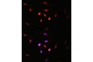 Immunofluorescence analysis of U2OS cells using KA antibody (ABIN7268768) at dilution of 1:100.