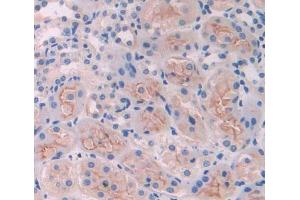 Used in DAB staining on fromalin fixed paraffin- embedded kidney tissue (CLTA anticorps  (AA 5-234))