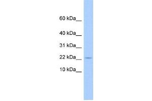WB Suggested Anti-C10orf132 Antibody Titration: 0. (GOLGA7B anticorps  (N-Term))