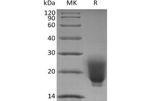 Western Blotting (WB) image for Fibronectin Type III Domain Containing 5 (FNDC5) protein (His tag) (ABIN7319826)