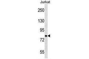 CACNB2 Antibody (Center) western blot analysis in Jurkat cell line lysates (35µg/lane). (CACNB2 anticorps  (Middle Region))