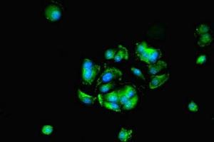 Immunofluorescent analysis of MCF-7 cells using ABIN7155305 at dilution of 1:100 and Alexa Fluor 488-congugated AffiniPure Goat Anti-Rabbit IgG(H+L)