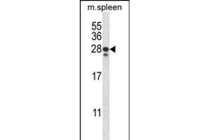 ANKRD22 Antibody (C-term) (ABIN657584 and ABIN2846587) western blot analysis in mouse spleen tissue lysates (35 μg/lane). (ANKRD22 anticorps  (C-Term))