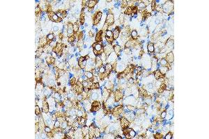 Immunohistochemistry of paraffin-embedded rat ovary using J Rabbit mAb (ABIN7268036) at dilution of 1:100 (40x lens). (JAK1 anticorps)