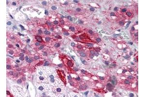 Human Adrenal (formalin-fixed, paraffin-embedded) stained with GRIK1at 5 µg/ml followed by biotinylated goat anti-rabbit IgG secondary antibody, alkaline phosphatase-streptavidin and chromogen. (GRIK1 anticorps  (Center))