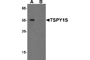 Western Blotting (WB) image for anti-TSPY1S (C-Term) antibody (ABIN1077409) (TSPY1S (C-Term) anticorps)