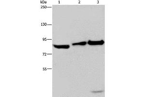 Western Blot analysis of NIH/3T3 cell, Mouse lung and liver tissue using MAPRE3 Polyclonal Antibody at dilution of 1:550 (ECE1 anticorps)
