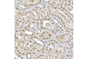 Immunohistochemistry of paraffin-embedded rat kidney using SNRPD1 Rabbit pAb (ABIN7270363) at dilution of 1:50 (40x lens). (SNRPD1 anticorps  (AA 1-100))
