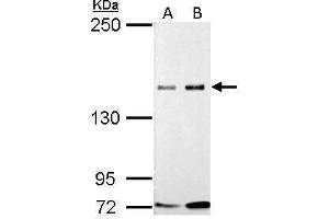 WB Image GLI3 antibody detects GLI3 protein by Western blot analysis. (GLI3 anticorps)