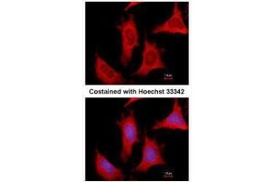 ICC/IF Image Immunofluorescence analysis of methanol-fixed HeLa, using PPAT, antibody at 1:500 dilution. (PPAT anticorps)
