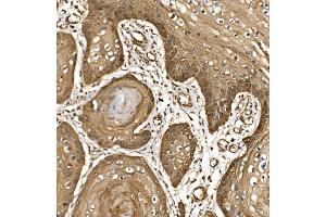 IHC analysis of EIF5 using anti-EIF5 antibody (ABIN7599722). (EIF5 anticorps  (AA 11-423))