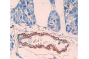 IHC-P analysis of Human Tissue, with DAB staining. (CPT1B anticorps  (AA 602-772))