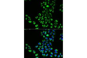 Immunofluorescence analysis of A549 cells using EIF5B antibody (ABIN6291145). (EIF5B anticorps)