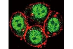 Confocal immunofluorescent analysis of PAK1 antibody with HeLa cells followed by Alexa Fluor 488-conjugated goat anti-rabbit lgG (green).