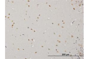 Immunoperoxidase of monoclonal antibody to ABL2 on formalin-fixed paraffin-embedded human cerebellum.