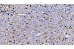 Detection of TOLLIP in Mouse Cerebrum Tissue using Polyclonal Antibody to Toll Interacting Protein (TOLLIP) (TOLLIP anticorps  (AA 19-254))