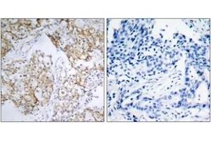 Immunohistochemistry (IHC) image for anti-Insulin-Like Growth Factor 1 Receptor (IGF1R) (pTyr1161) antibody (ABIN2888441) (IGF1R anticorps  (pTyr1161))