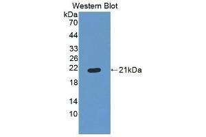 Detection of Recombinant ES, Human using Polyclonal Antibody to Endostatin (ES)