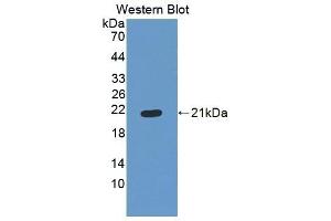 Detection of Recombinant ES, Human using Polyclonal Antibody to Endostatin (ES) (COL18A1 anticorps  (AA 1154-1335))