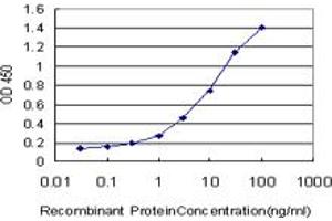 Detection limit for recombinant GST tagged SERPINB2 is approximately 0.