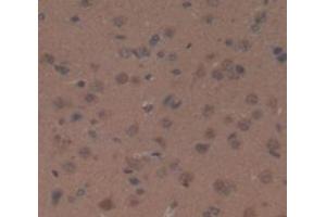 IHC-P analysis of Rat Tissue, with DAB staining. (Ceruloplasmin anticorps  (AA 872-1059))