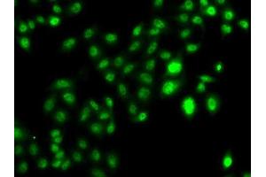 Immunofluorescence analysis of U2OS cells using CBFA2T2 antibody. (CBFA2T2 anticorps  (AA 325-604))