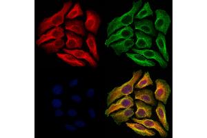 ABIN6264177 and ABIN6273064 staining Hela cells by IF/ICC. (PHGDH anticorps  (N-Term))