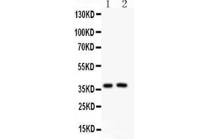 Anti-PD1 Picoband antibody , All lanes: Anti PD1  at 0. (PD-1 anticorps  (AA 101-288))