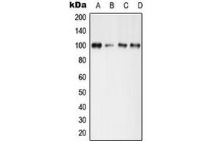 Western blot analysis of GLUR4 (pS862) expression in MCF7 Forskonlin-treated (A), mouse brain (B), mouse spleen (C), rat spleen (D) whole cell lysates. (GRIA4 anticorps  (C-Term, pSer862))