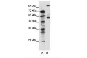 Image no. 1 for anti-5-Hydroxytryptamine (serotonin) Receptor 7 (Adenylate Cyclase-Coupled) (HTR7) (AA 47-96) antibody (ABIN6736094) (HTR7 anticorps  (AA 47-96))