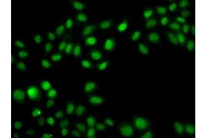 Immunofluorescence analysis of A549 cells using SULT2B1 antibody.