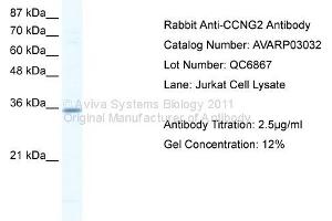 WB Suggested Anti-CCNG2 Antibody Titration: 2.