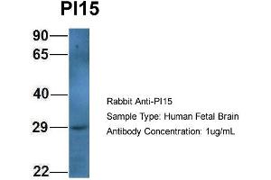 Host: Rabbit Target Name: PI15 Sample Type: Human Fetal Brain Antibody Dilution: 1. (PI15 anticorps  (N-Term))