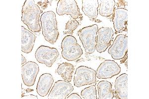 Immunohistochemistry (IHC) image for anti-Carcinoembryonic Antigen-Related Cell Adhesion Molecule 1 (CEACAM1) (AA 35-141) antibody (ABIN7455130)