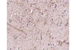 Immunohistochemistry of TOM70 in mouse brain tissue with this product at 2. (TOM70 anticorps  (N-Term))