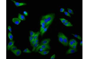 Immunofluorescence staining of HepG2 cells with ABIN7160161 at 1:200, counter-stained with DAPI.