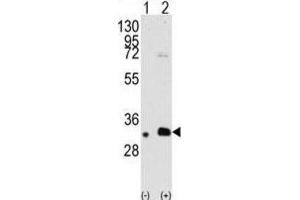 Western Blotting (WB) image for anti-Melanoma Antigen Family B, 2 (MAGEB2) antibody (ABIN3002533) (MAGEB2 anticorps)