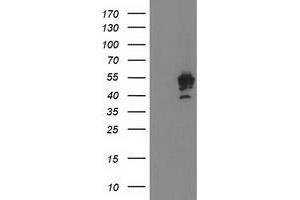 Western Blotting (WB) image for anti-Protein tyrosine Phosphatase, Non-Receptor Type 7 (PTPN7) antibody (ABIN1500502) (PTPN7 anticorps)