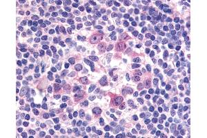 Anti-FLT3 / CD135 antibody IHC of human tonsil.