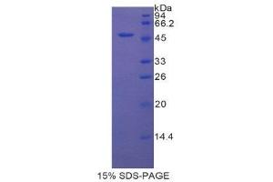 SDS-PAGE (SDS) image for Protease, serine, 8 (PRSS8) (AA 124-342) protein (His tag,GST tag) (ABIN1878245)