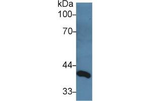 Western Blot; Sample: Rat Serum; Primary Ab: 3µg/ml Rabbit Anti-Rat dLK1 Antibody Second Ab: 0. (DLL1 anticorps  (AA 81-311))