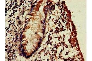 Immunohistochemistry of paraffin-embedded human appendix tissue using ABIN7175703 at dilution of 1:100