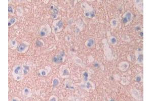 DAB staining on IHC-P;;Samples: Human Cerebrum Tissue