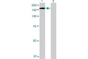 Western Blot analysis of PHKA2 expression in transfected 293T cell line by PHKA2 MaxPab polyclonal antibody. (PHKA2 anticorps  (AA 1-1235))