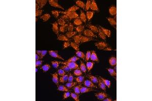 Immunofluorescence analysis of HeLa cells using  Rabbit pAb (ABIN1678653, ABIN5664340, ABIN5664342 and ABIN6220284) at dilution of 1:100.