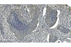 IHC analysis of LSM5 using anti-LSM5 antibody (ABIN7602503).